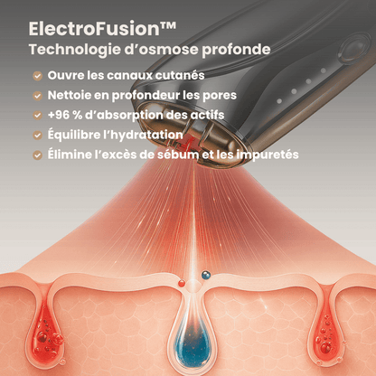 VelvaLift | 3-in-1 Therapy with Radiofrequency, EMS, and Red Light